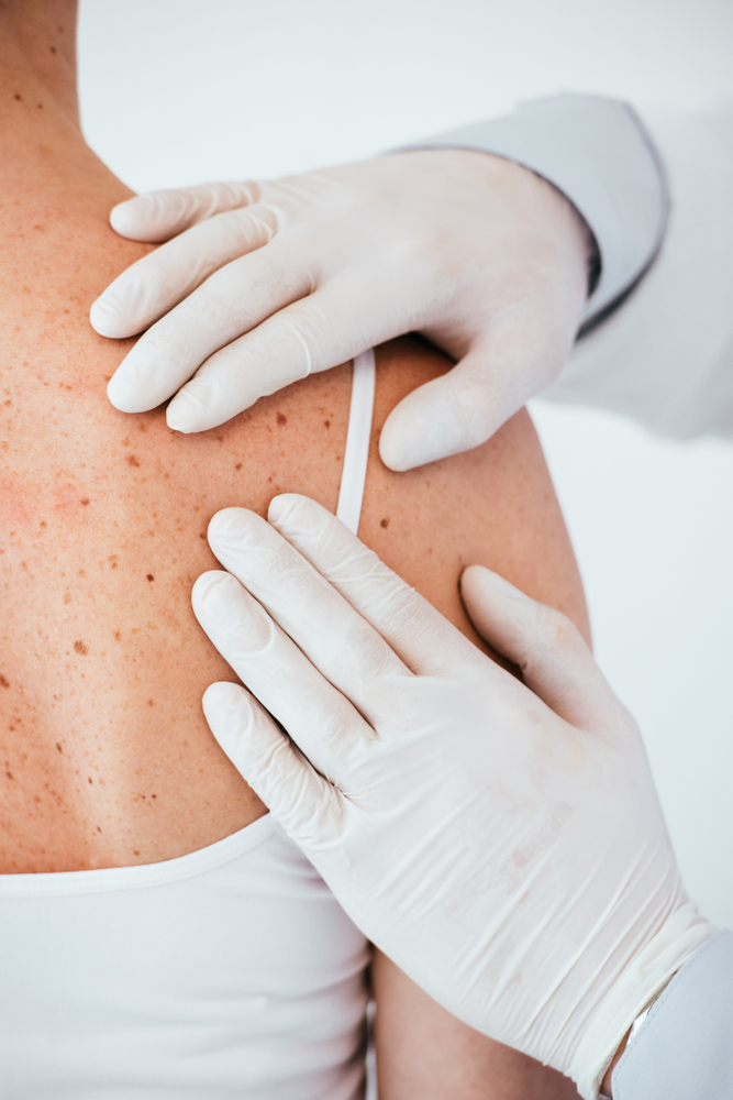 seo-for-dermatology-practices